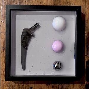 Medical Art- Orthopedic Hardware Resin Art